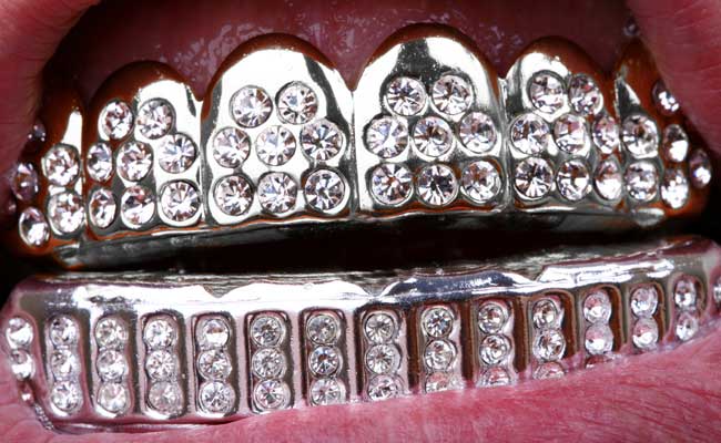 A Dental Grill with Diamonds