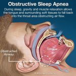 Normal anatomy and function during sleep