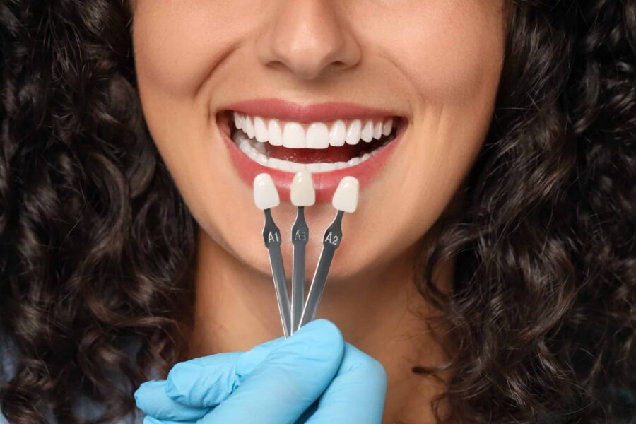 Dental Veneers Palmdale